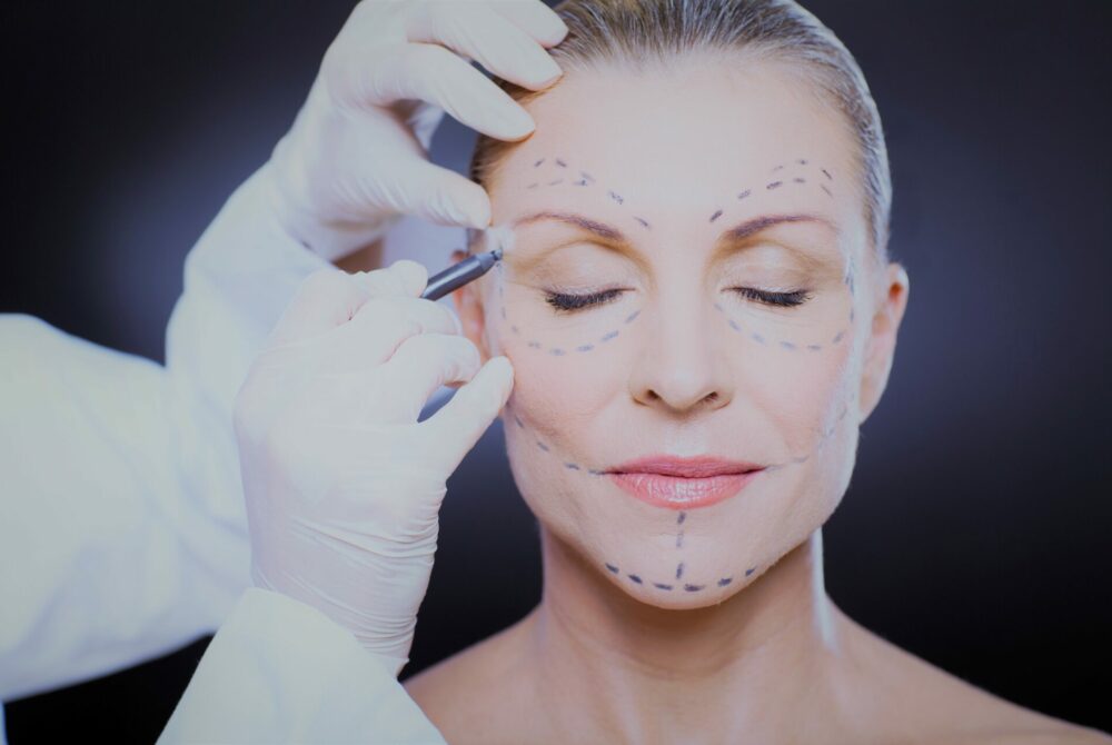 middle aged woman preparing for plastic surgery